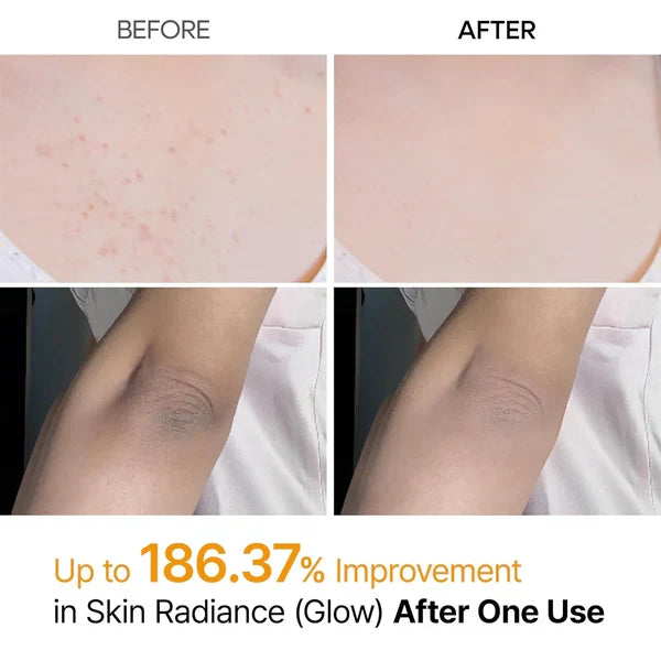 Body Peel Shot Spray