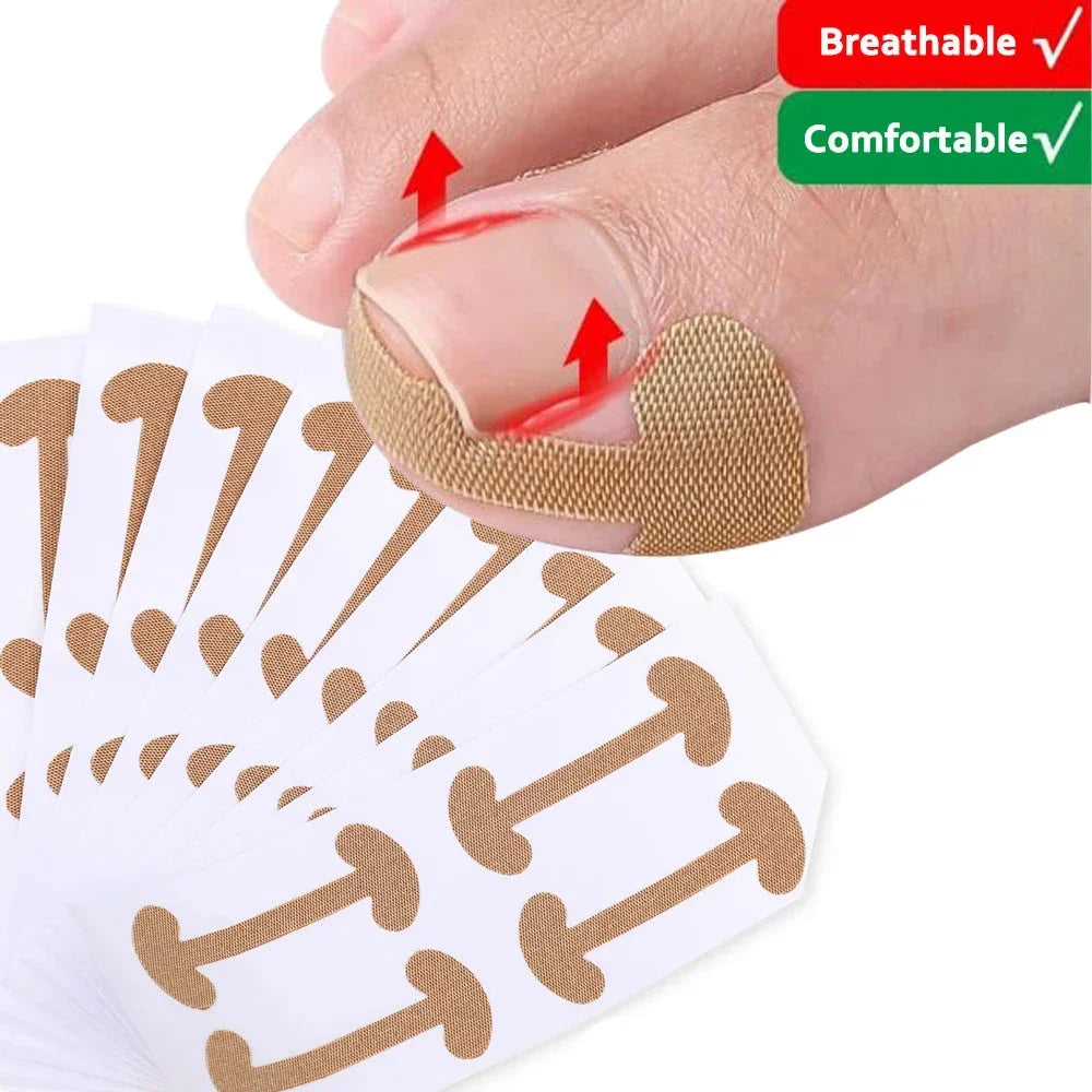Toenail Correction Strips